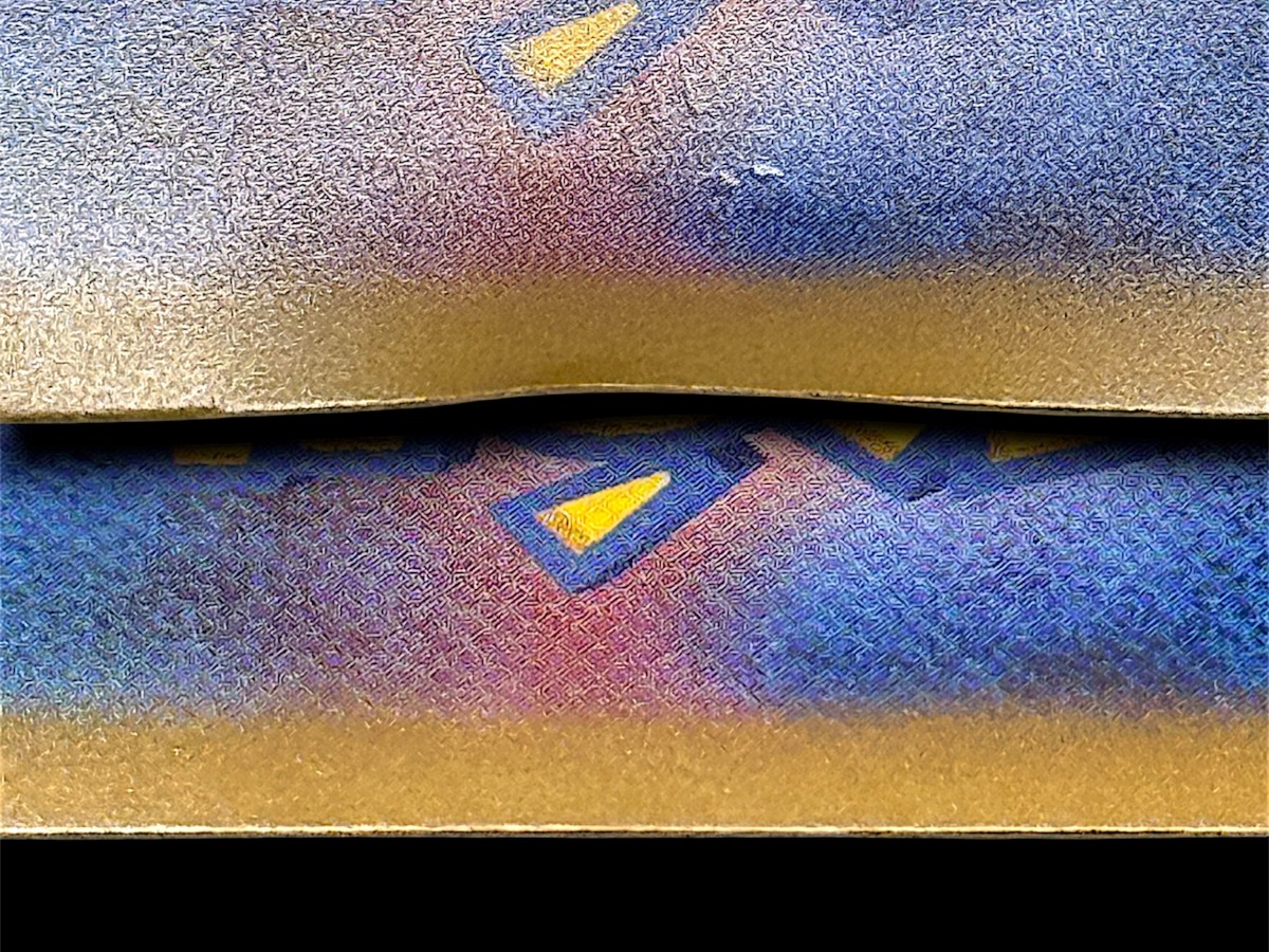 縁のめくれ(Edge Lift)の症例写真 2